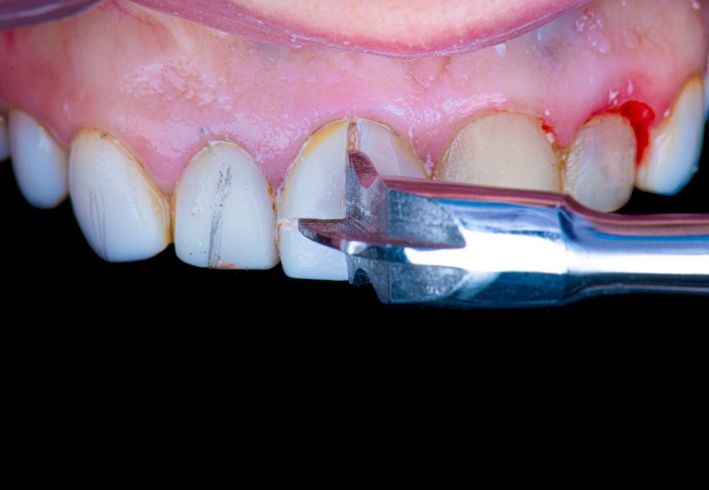 FB_IMG_1717580882166