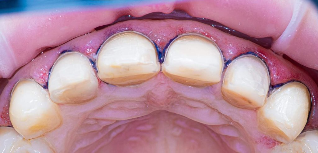 FB_IMG_1717580949111