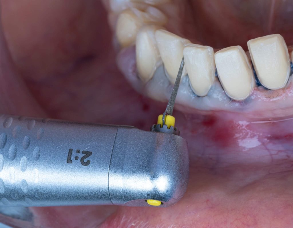 FB_IMG_1717580986695