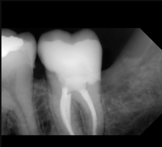 FURKAN GOKARSLAN YENİ