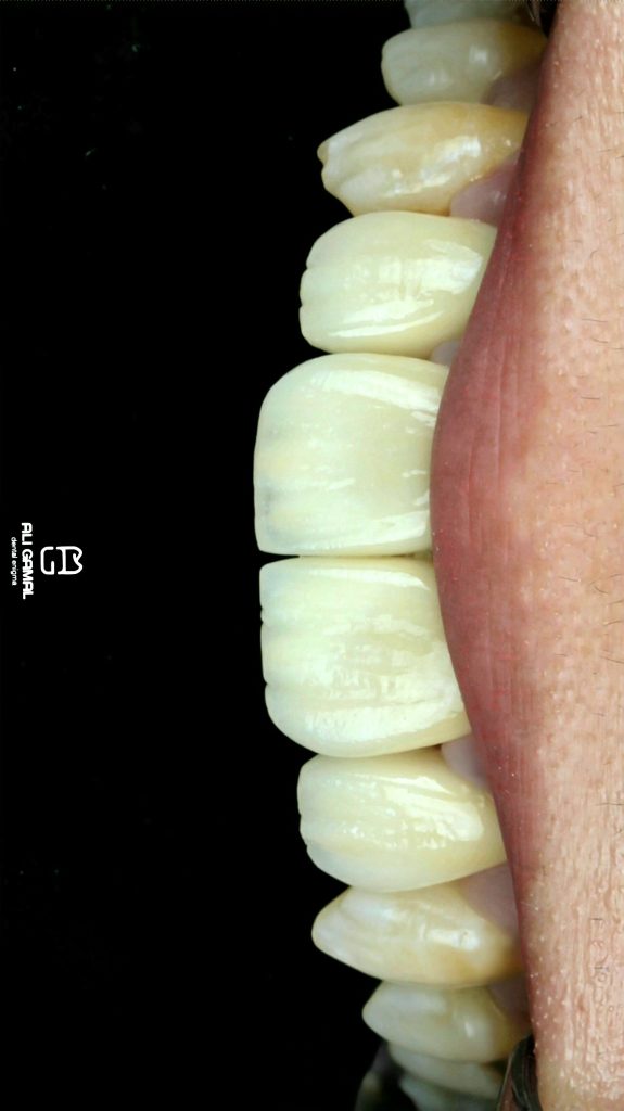 RemasterDirector_1a5c03258