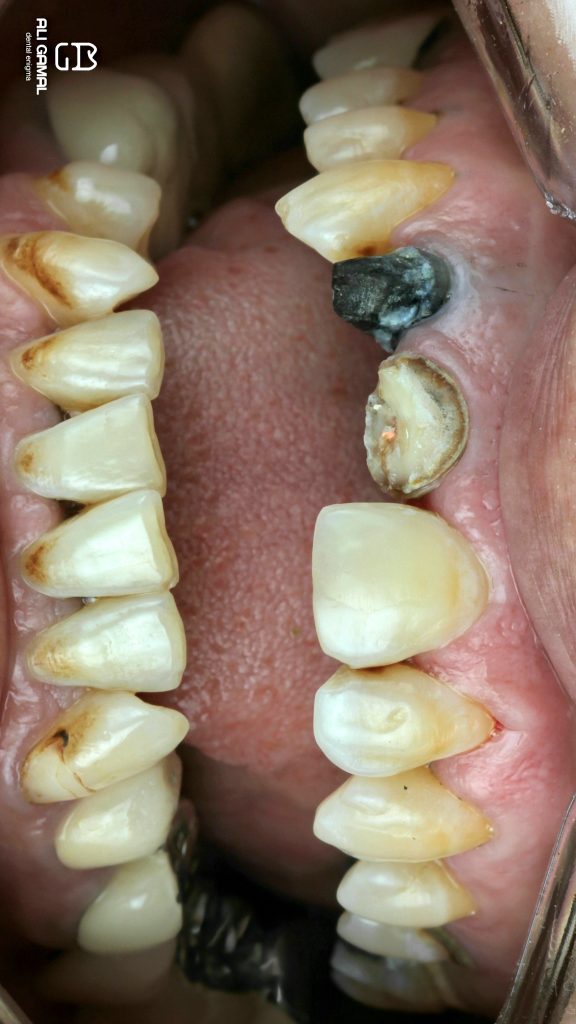 RemasterDirector_1a5c03258