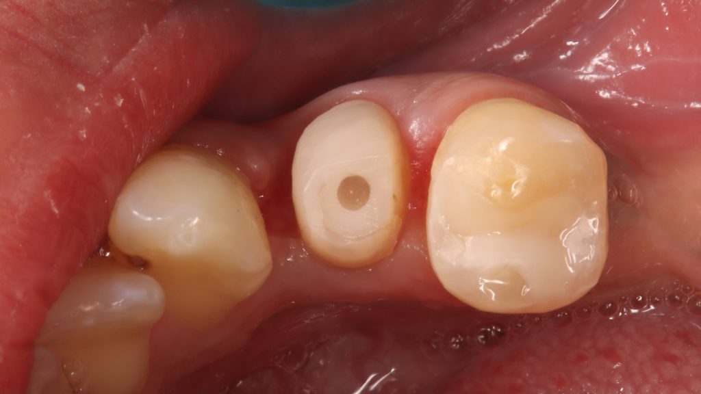 inbound8579969257015315836