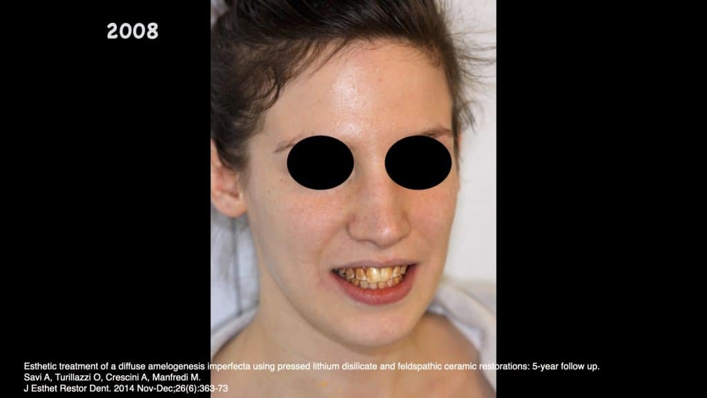 zerodonto aggiornamento.001