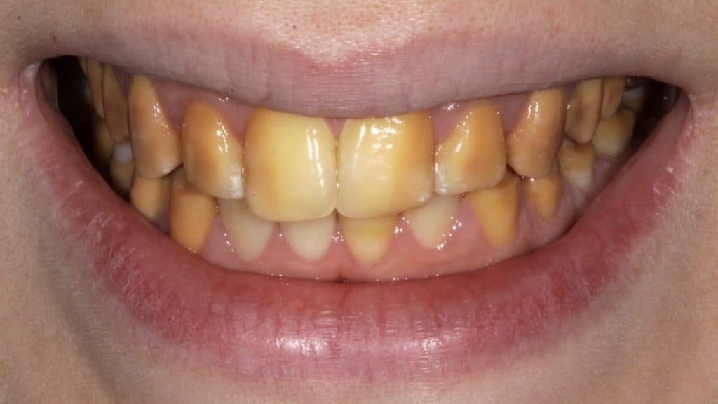 zerodonto aggiornamento.002