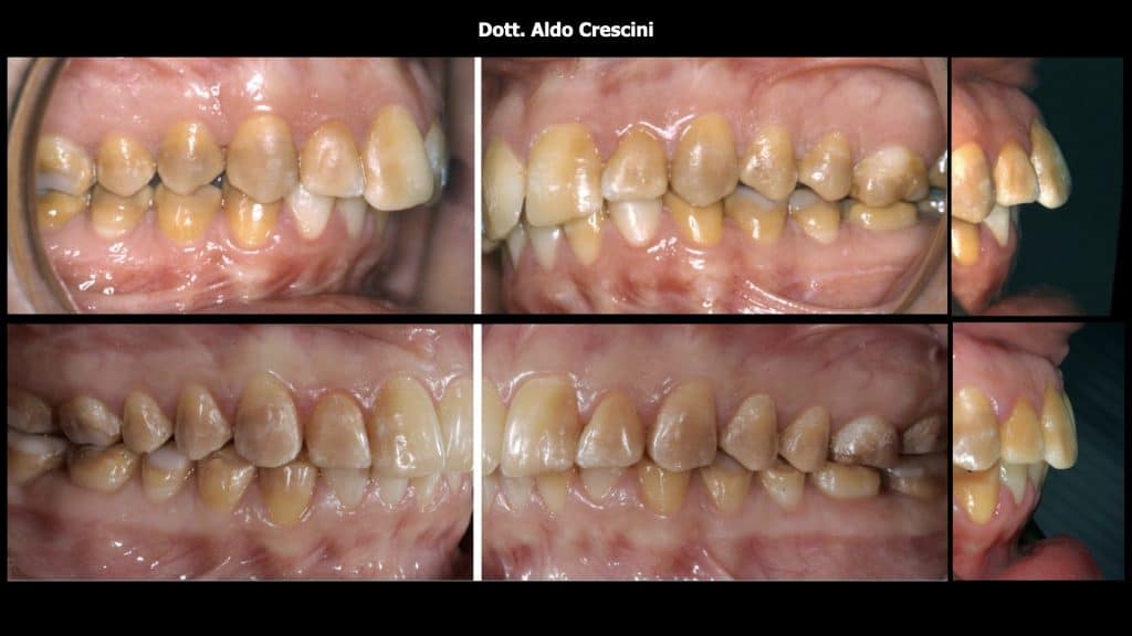 zerodonto aggiornamento.003