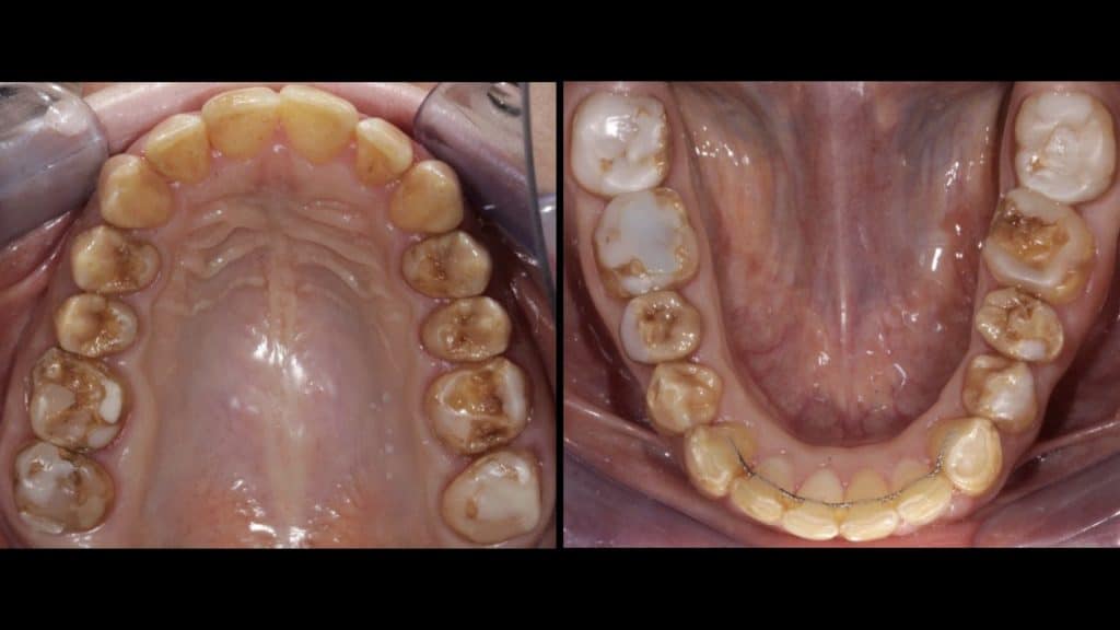 zerodonto aggiornamento.004