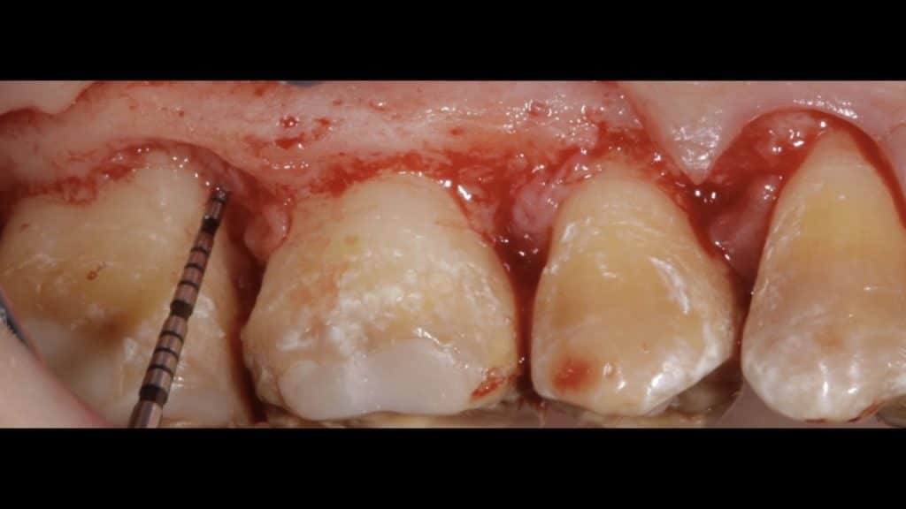 zerodonto aggiornamento.005