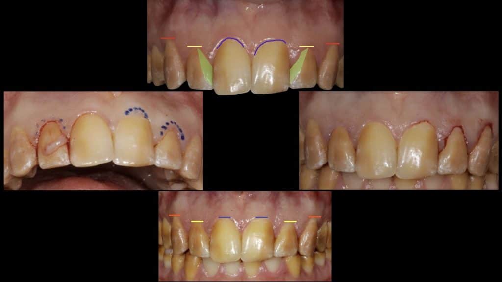 zerodonto aggiornamento.007