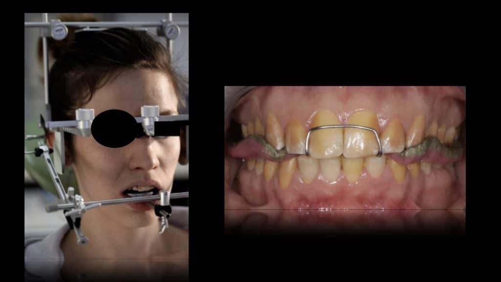 zerodonto aggiornamento.008