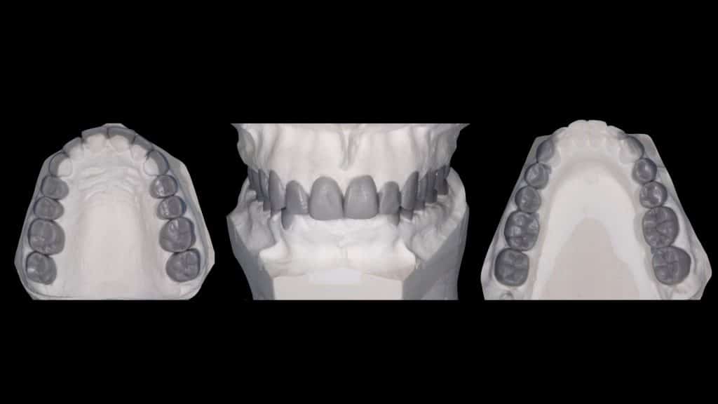 zerodonto aggiornamento.009