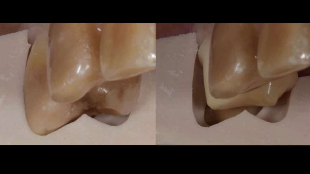 zerodonto aggiornamento.010