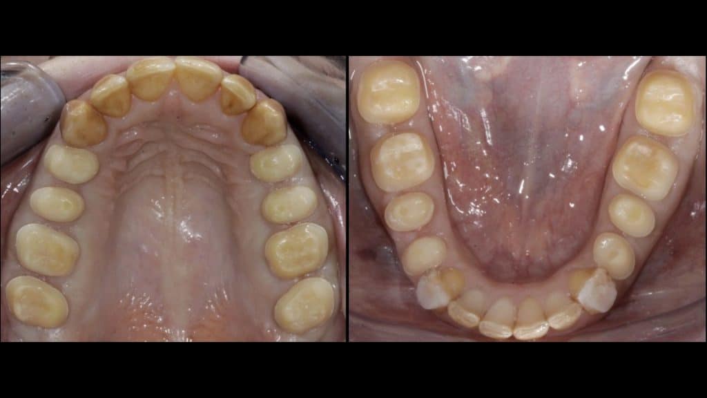 zerodonto aggiornamento.011