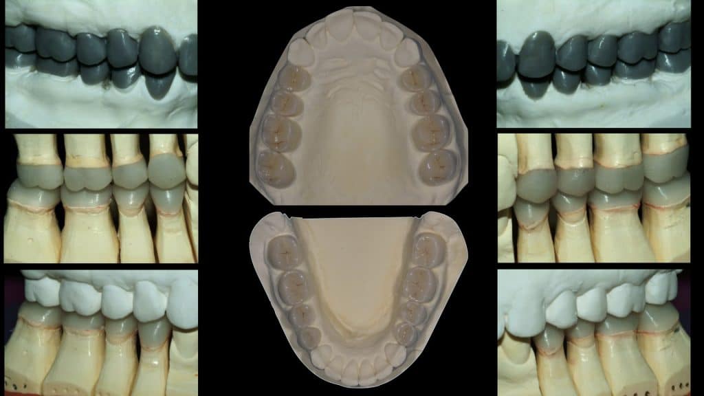 zerodonto aggiornamento.012