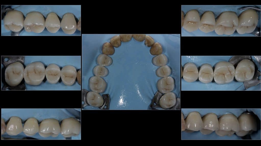 zerodonto aggiornamento.014