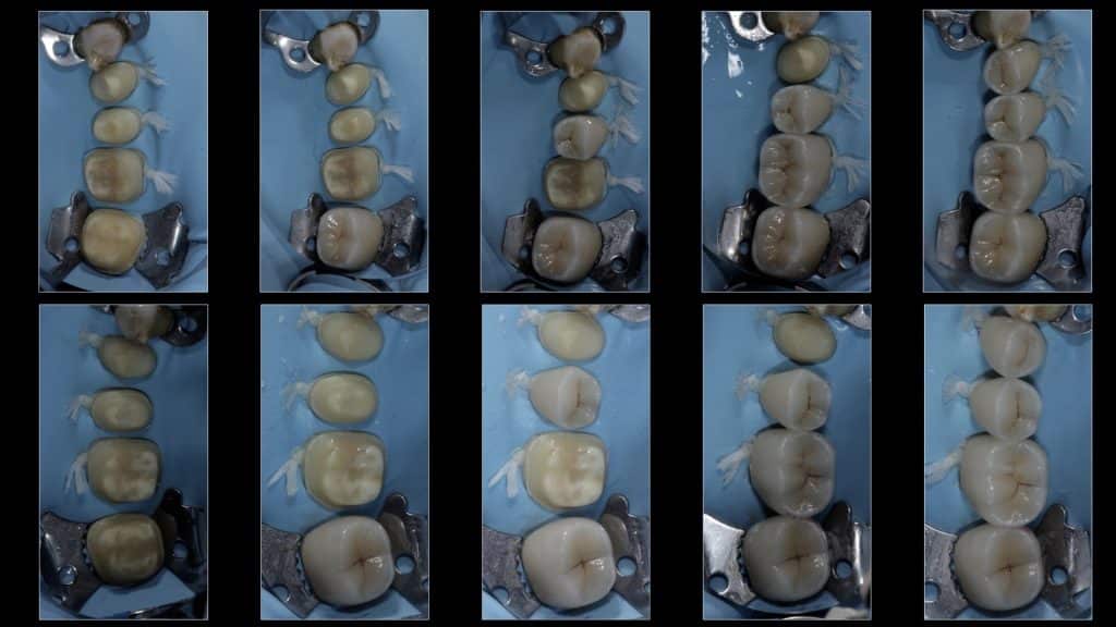 zerodonto aggiornamento.015