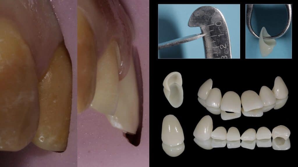 zerodonto aggiornamento.016