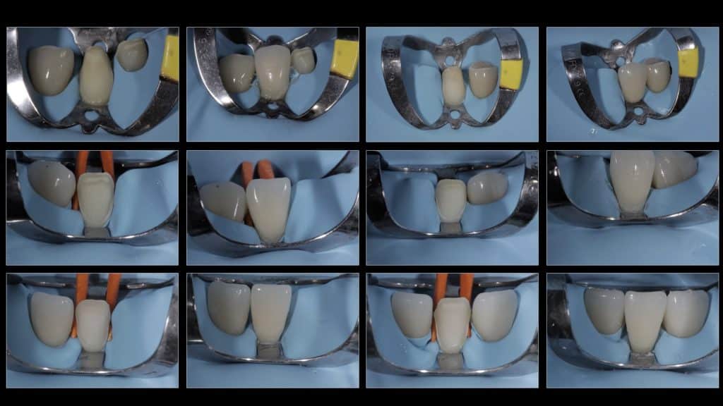 zerodonto aggiornamento.017