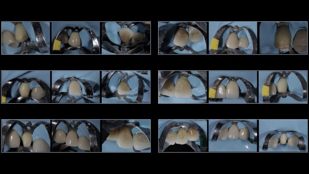 zerodonto aggiornamento.018