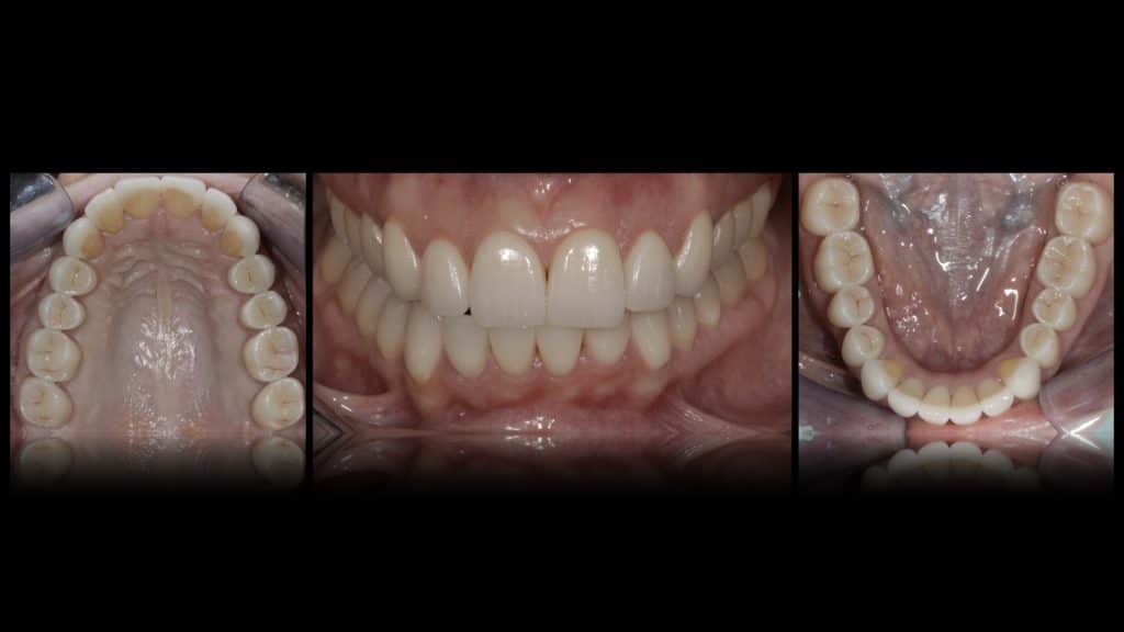 zerodonto aggiornamento.019