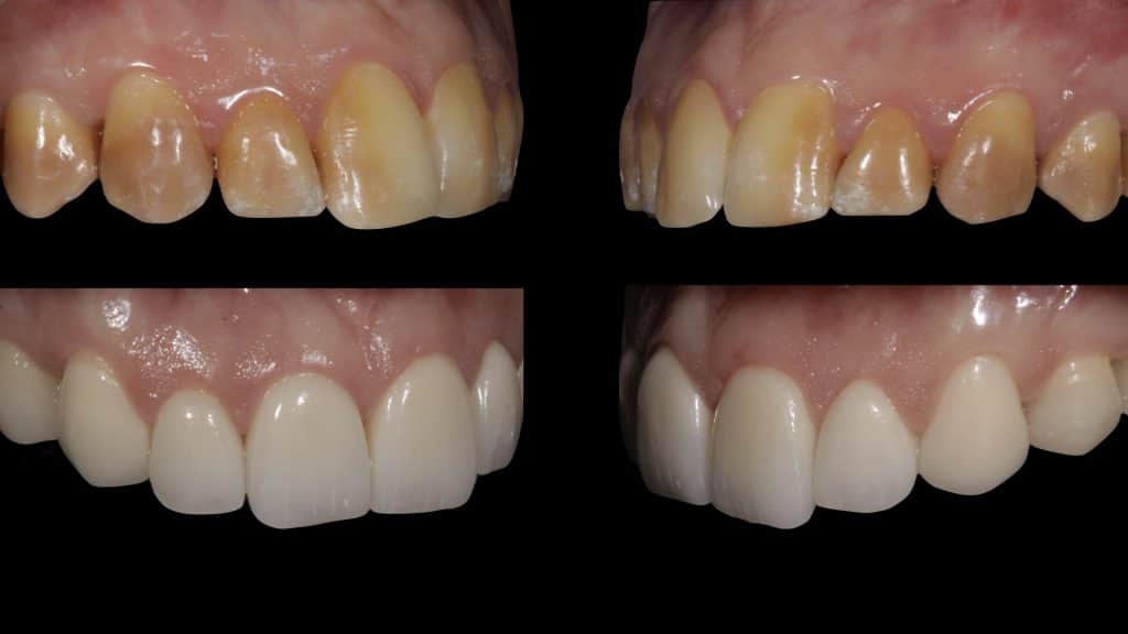 zerodonto aggiornamento.020