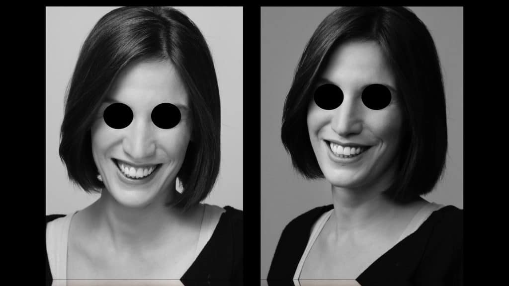 zerodonto aggiornamento.024