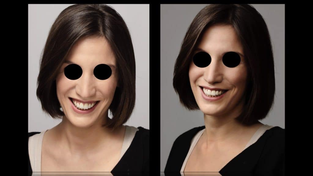 zerodonto aggiornamento.025