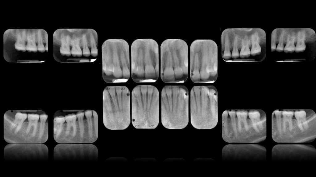 zerodonto aggiornamento.026