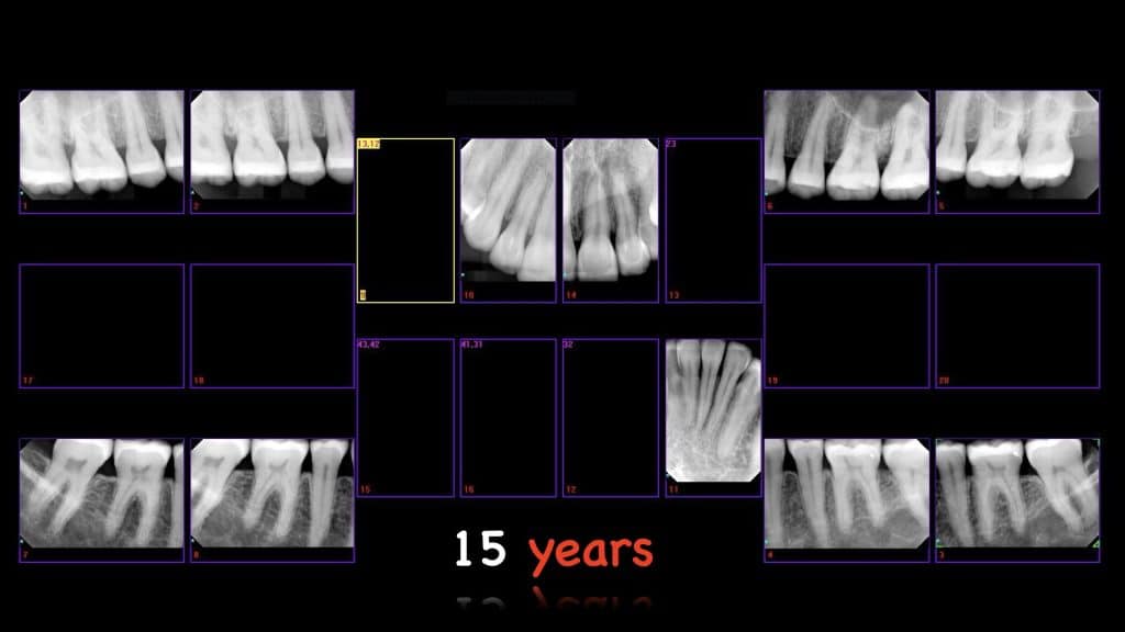 zerodonto aggiornamento.027