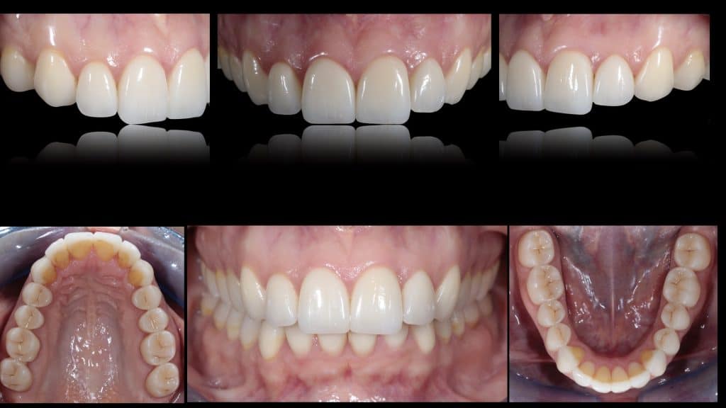 zerodonto aggiornamento.028