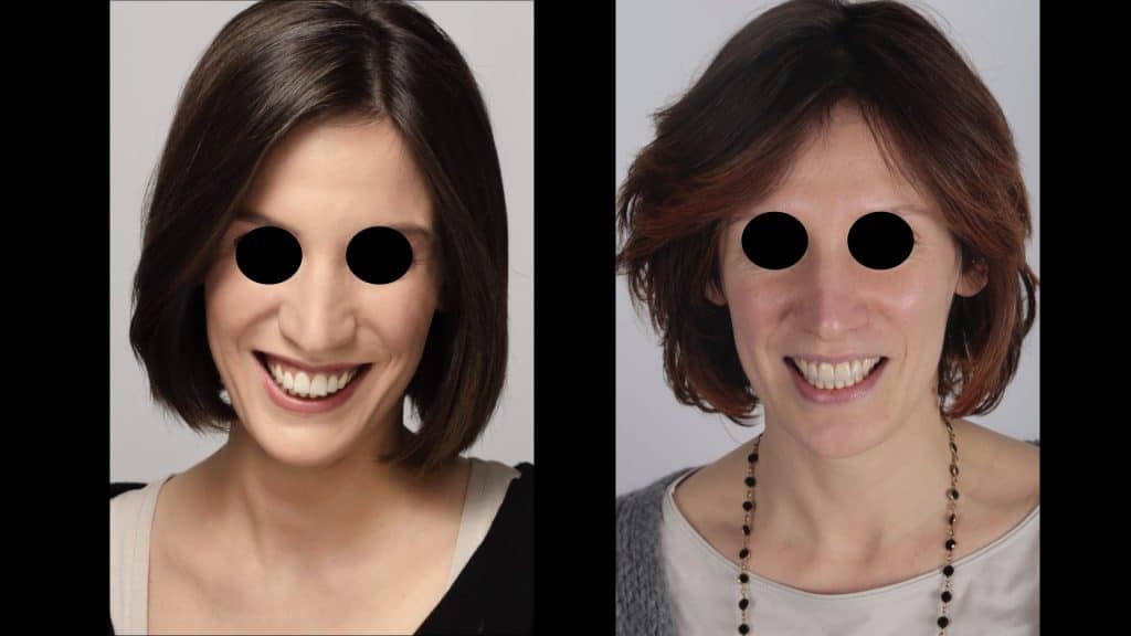 zerodonto aggiornamento.030