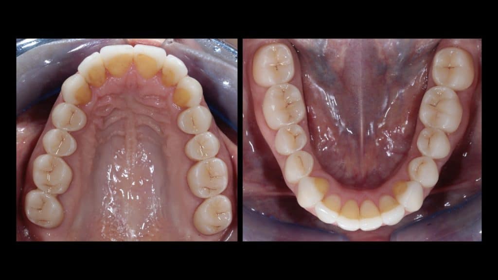 zerodonto aggiornamento.031