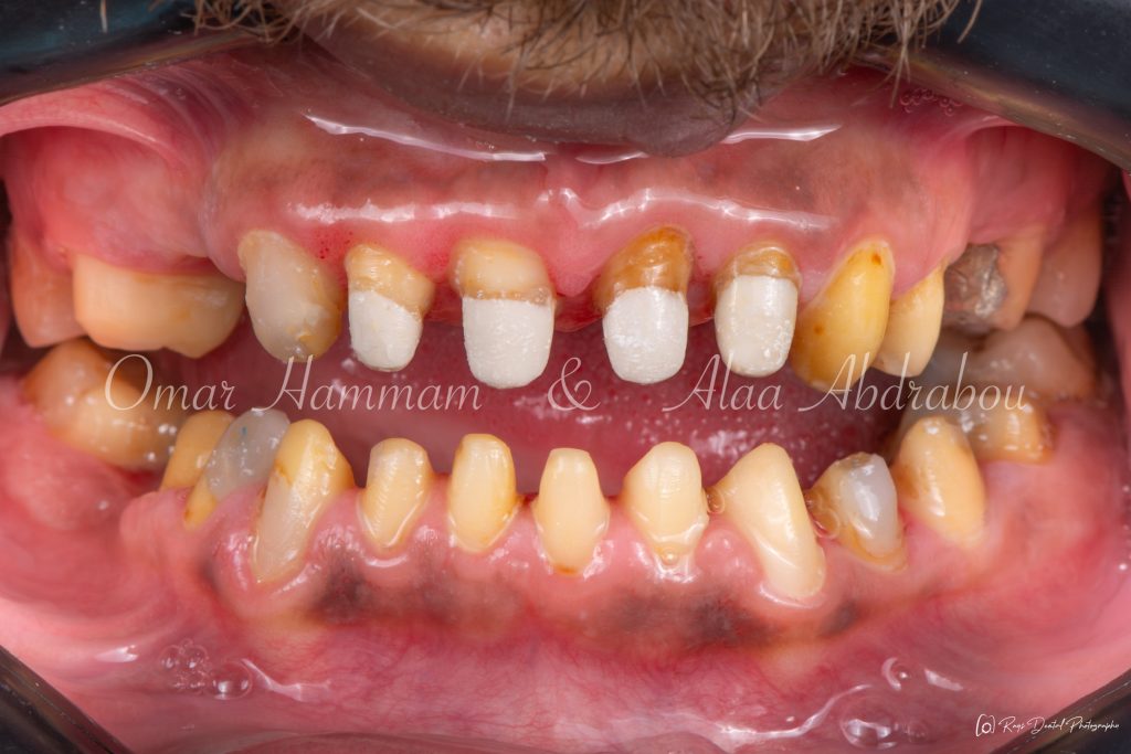 DSC_6443-Enhanced-NR