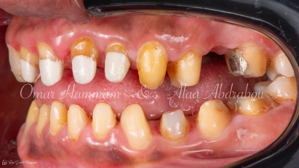 DSC_6446-Enhanced-NR