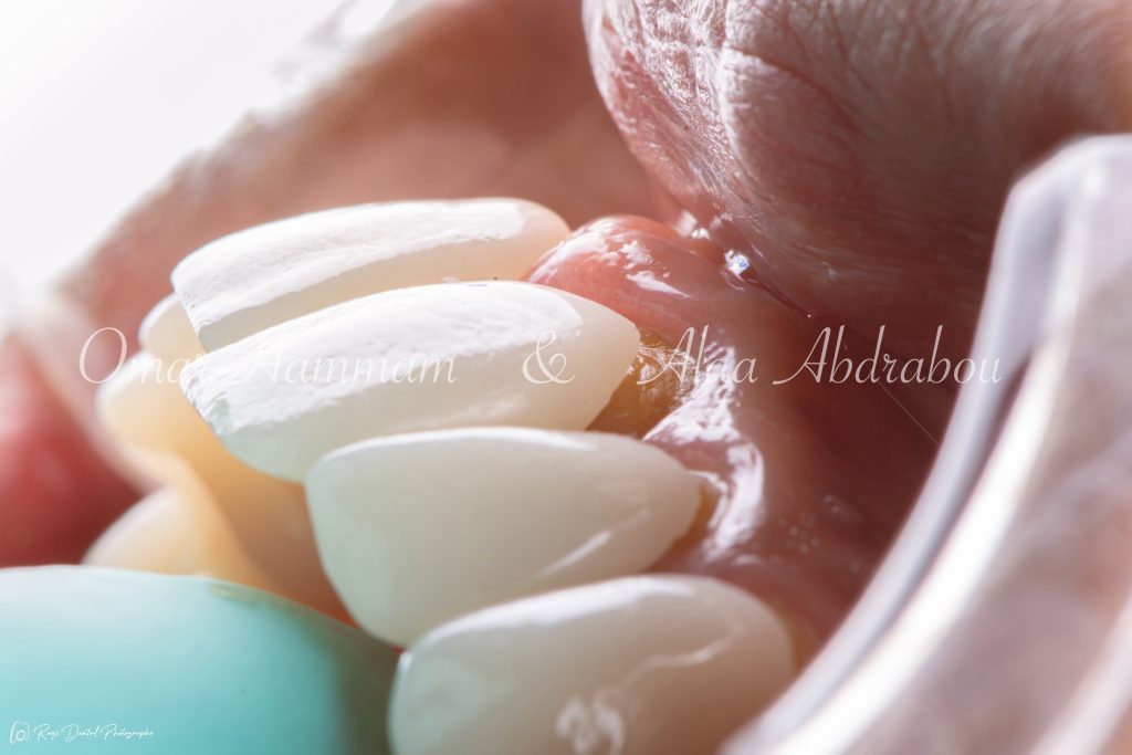 DSC_6565-Enhanced-NR