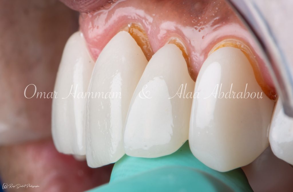 DSC_6577-Enhanced-NR