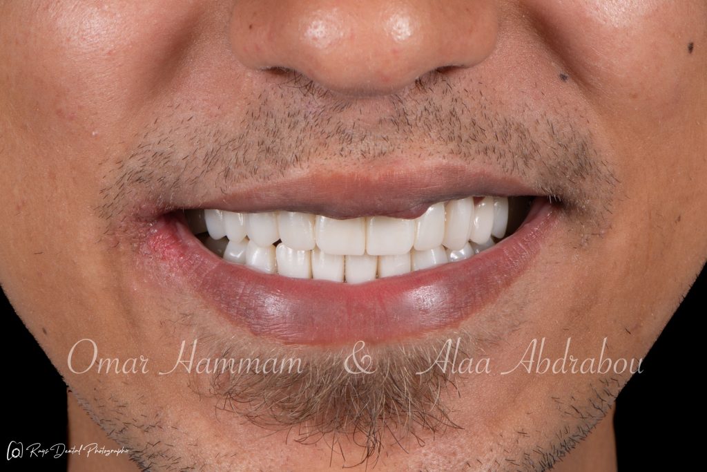 DSC_6648-Enhanced-NR