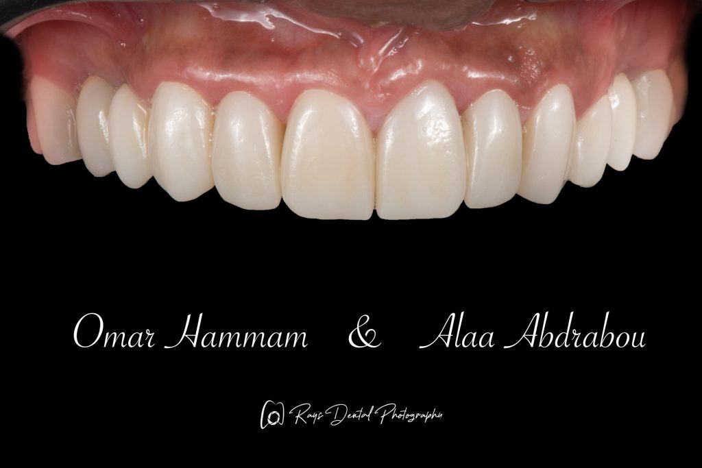 DSC_6663-Enhanced-NR