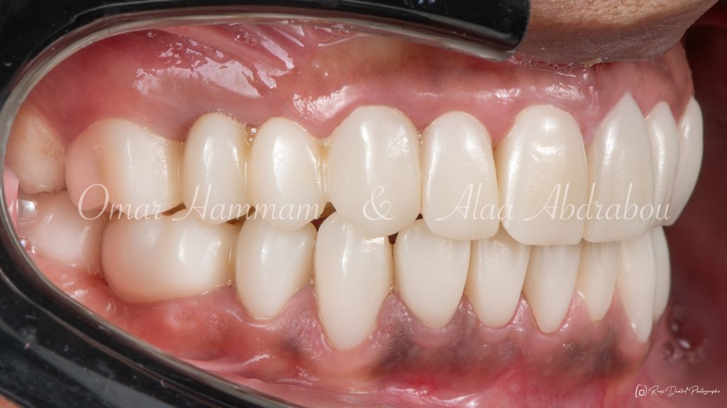 DSC_6673-Enhanced-NR