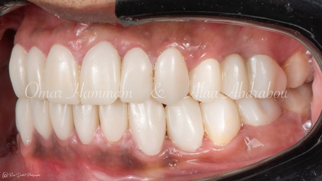 DSC_6677-Enhanced-NR