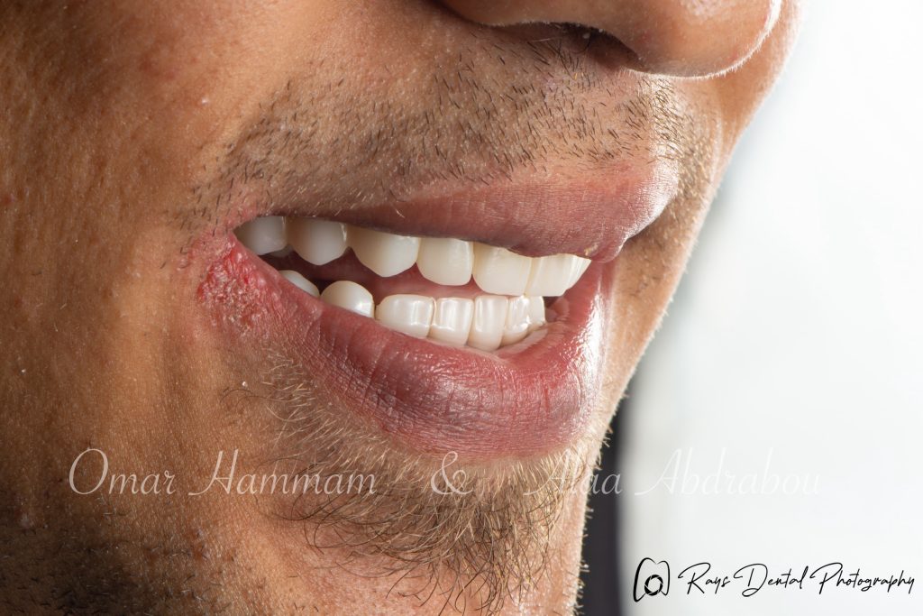 DSC_6689-Enhanced-NR