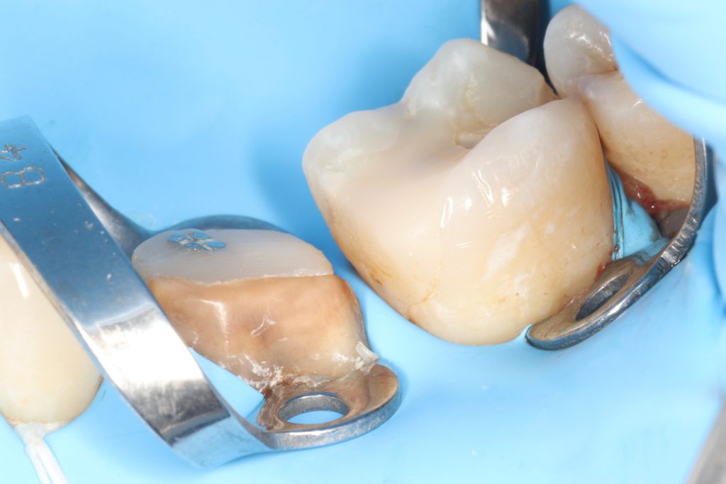 Facetune_11-06-2024-15-40-07