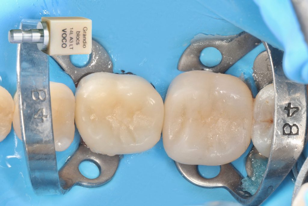 Facetune_11-06-2024-18-32-20