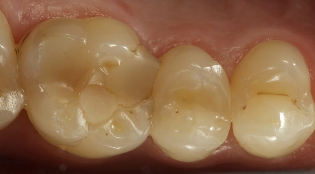 IMG_4999_Facetune_17-07-2024-19-51-17