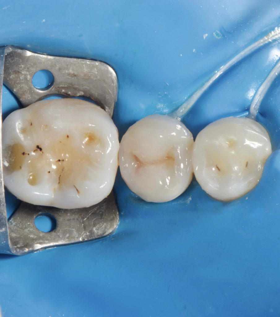 IMG_5064_Facetune_17-07-2024-18-21-09