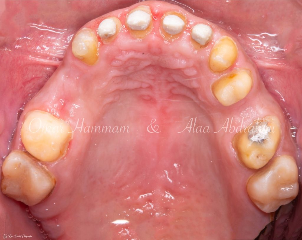 Photoroom_20240428_202237