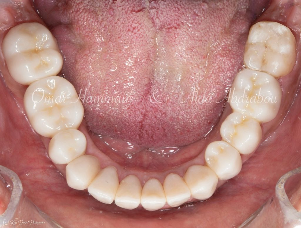 Photoroom_20240504_153640