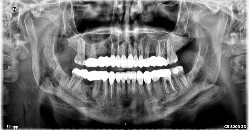 Photoroom_20240518_231002