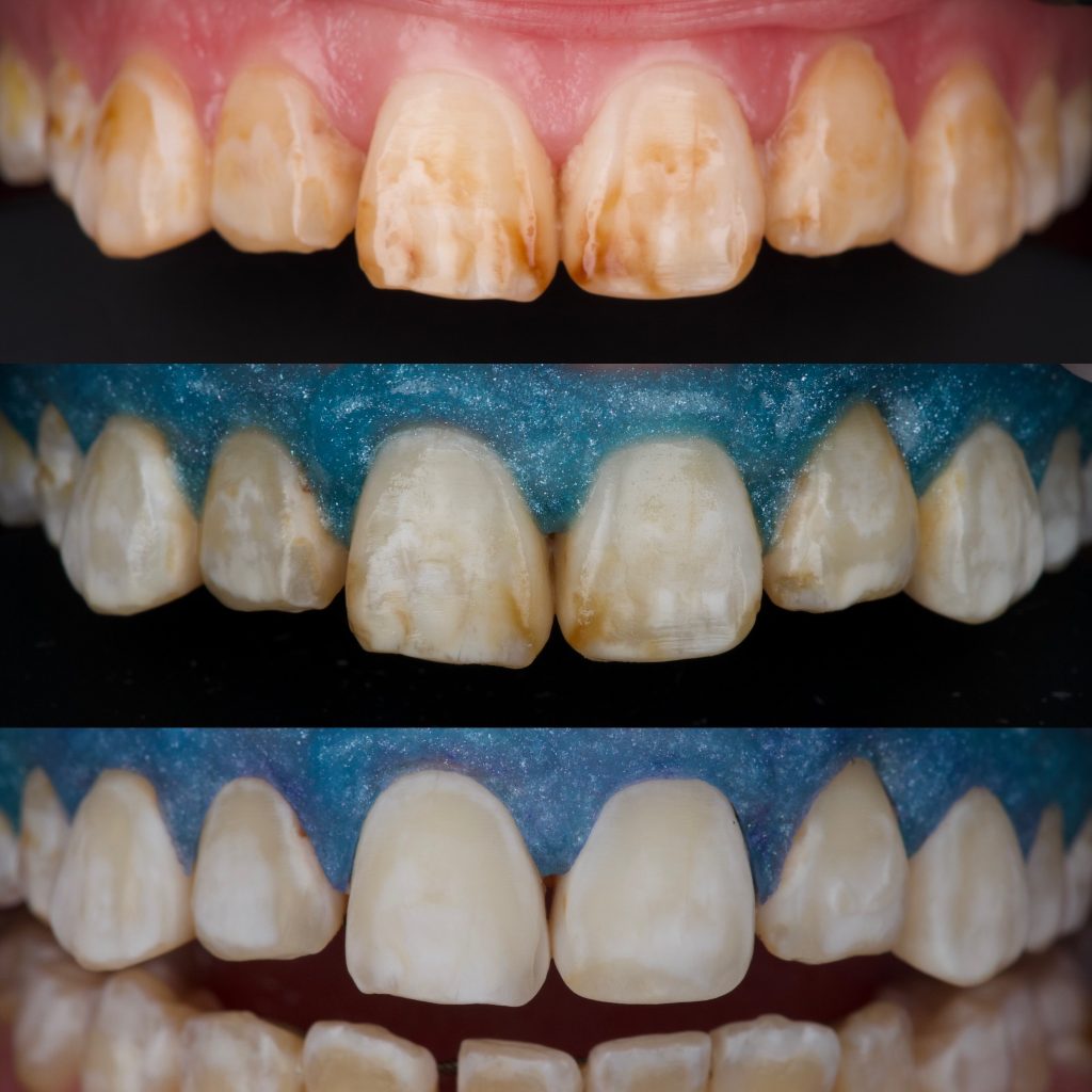 00673496-F765-44CC-830F-6916117EF359