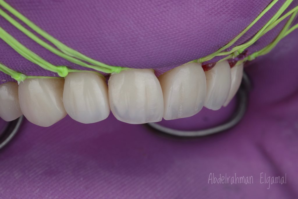 0EE7FB0F-D361-41E7-A027-4E5AB788BD0A